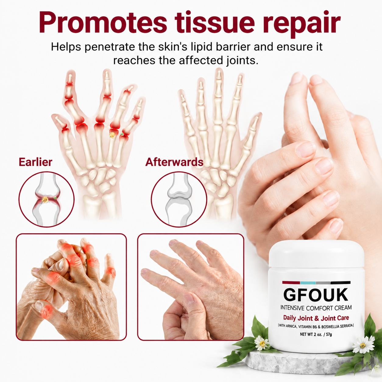 GFOUK®  🧑‍⚕️✅Pain-ReIief Bone HeaIing Cream US (SpeciaIIy or older adults)