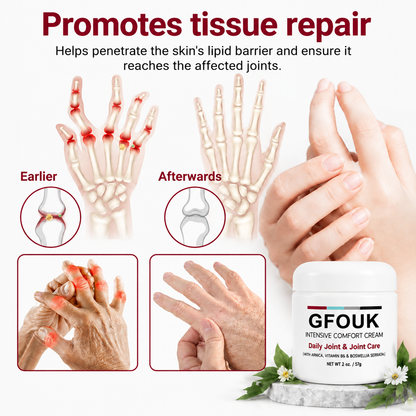 GFOUK®  🧑‍⚕️✅Pain-ReIief Bone HeaIing Cream US (SpeciaIIy or older adults)