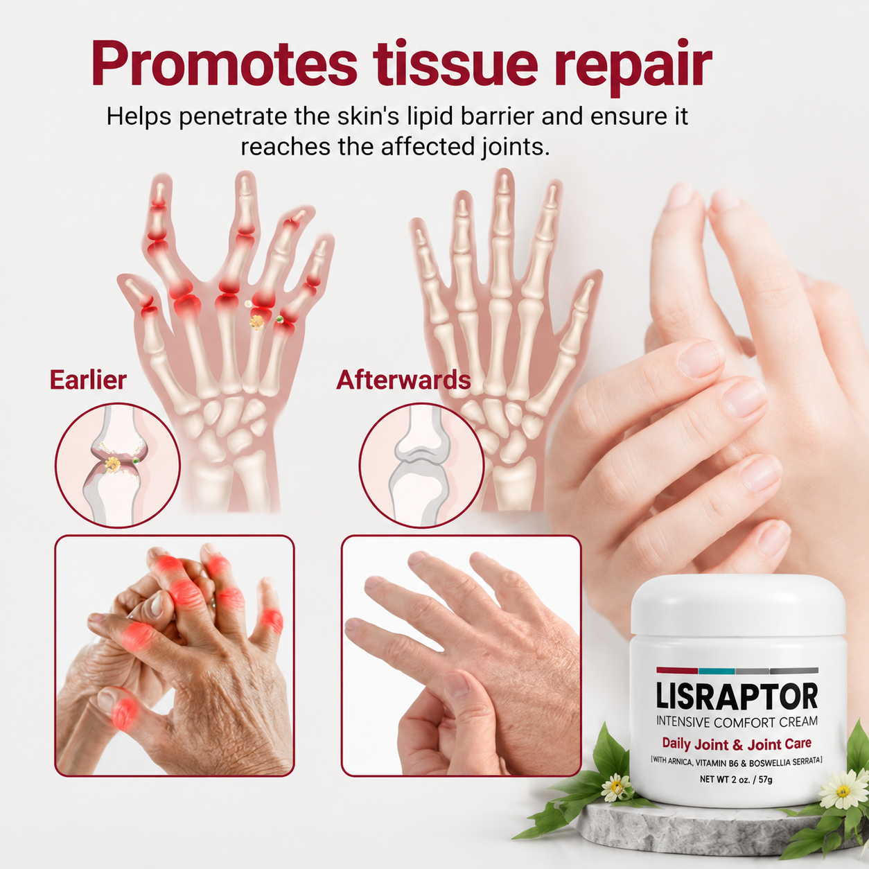 LISRAPTOR®  🧑‍⚕️✅Pain-ReIief Bone HeaIing Cream US (SpeciaIIy or older adults)